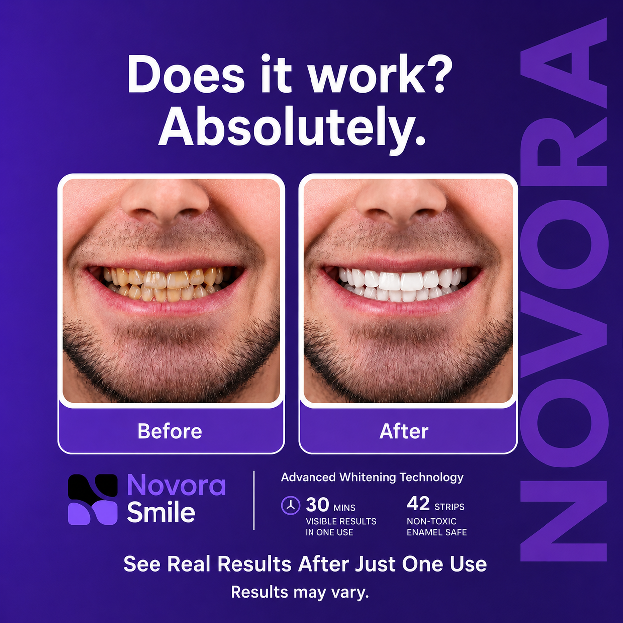 Novora Smile Whitening Strips detail