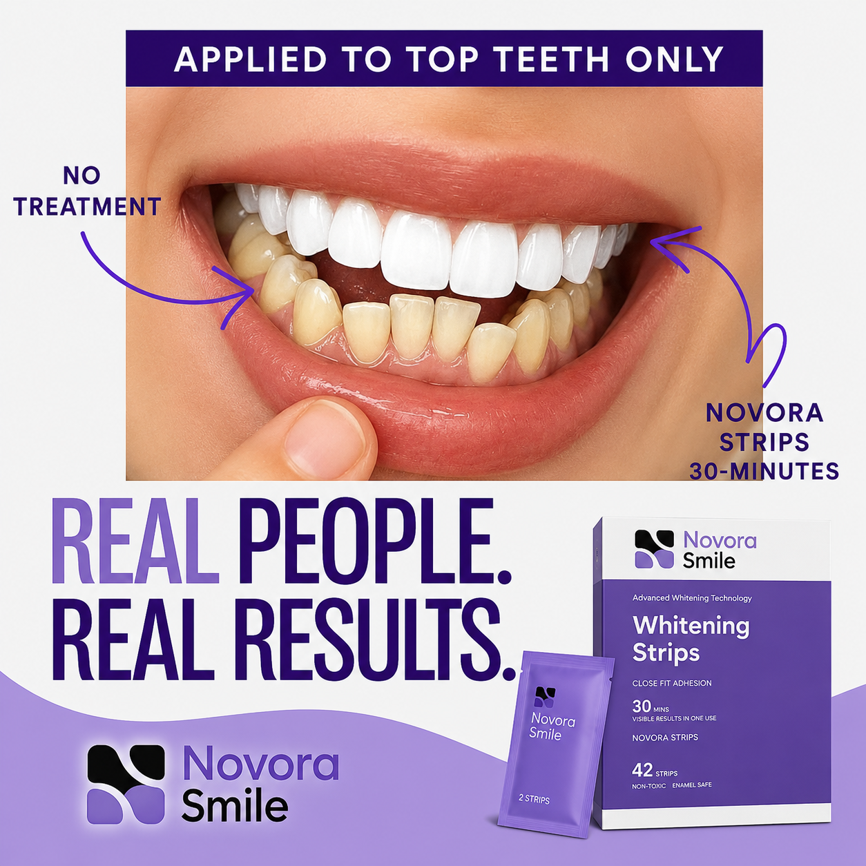 Novora Smile Whitening Strips packaging